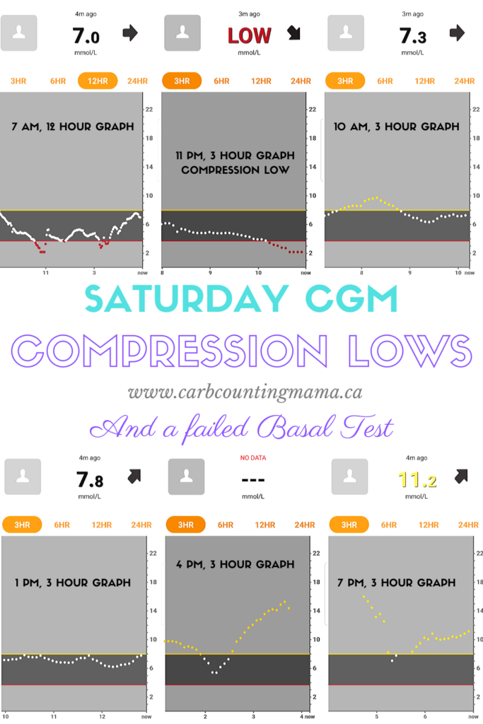 Saturday CGM Compression Lows